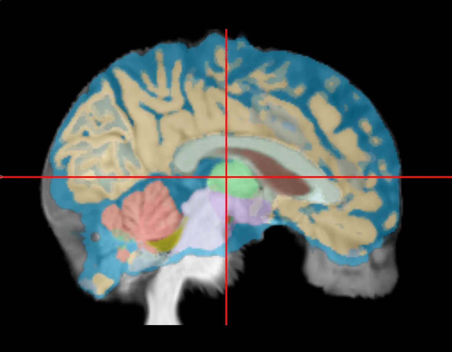 Brain segmentation visualization
